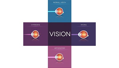 vision chart
